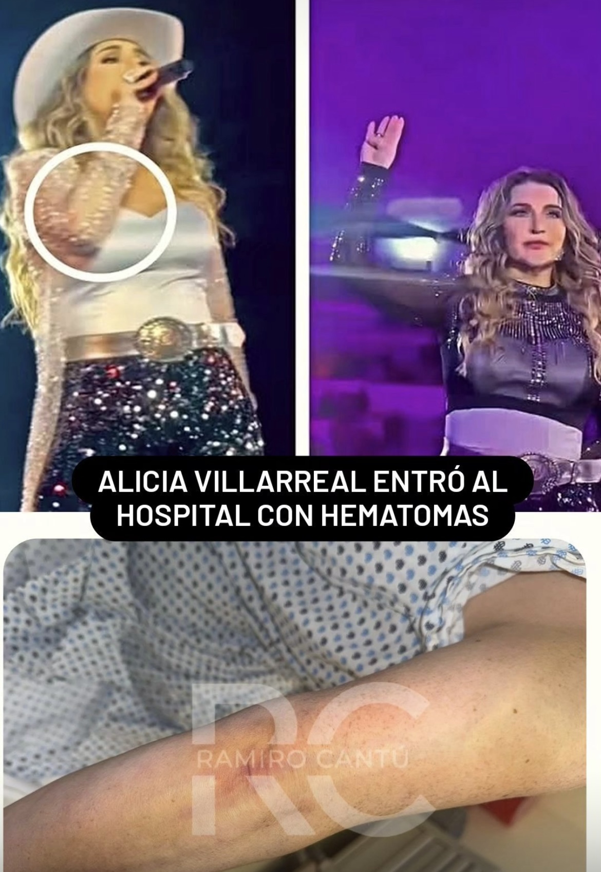 Imagen eliminada.