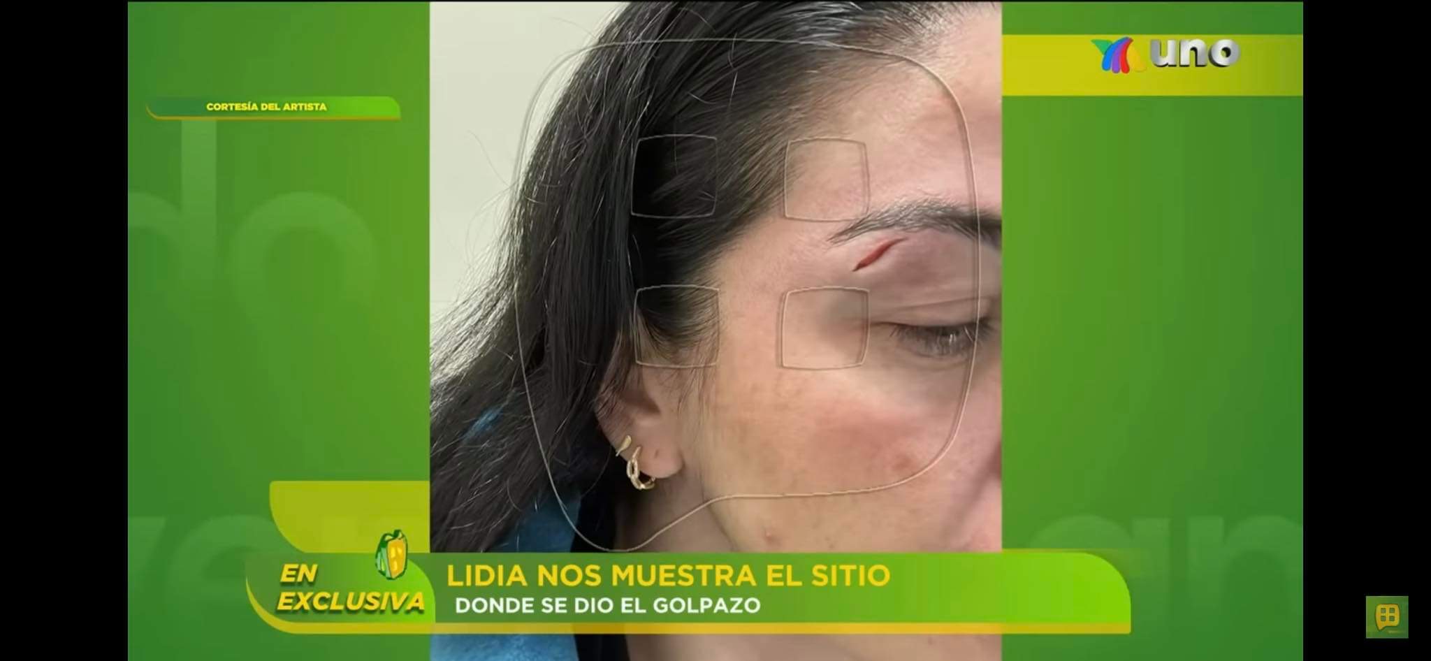 Imagen eliminada.