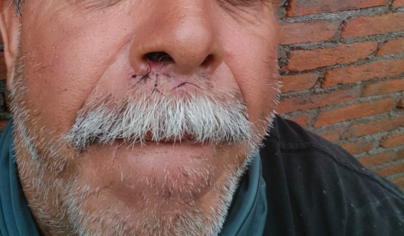 Imagen eliminada.