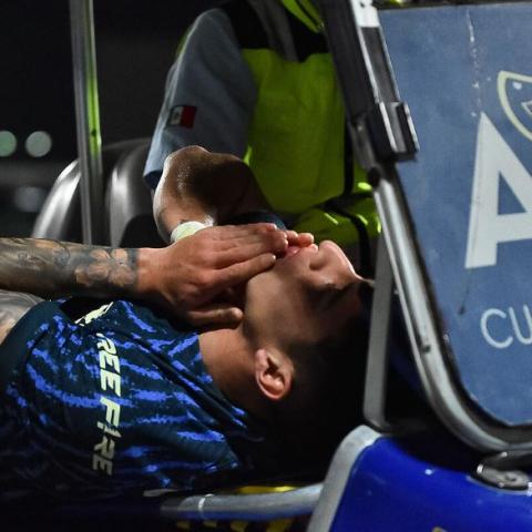 Se lesiona jugador clave para el club América 