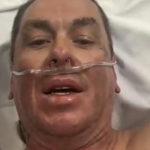 Hospitalizan a integrante de Slipknot tras sufrir quemaduras en rostro y brazos 