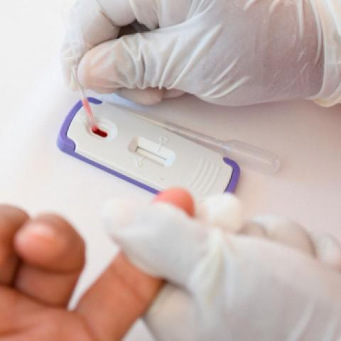 Hay más de 2 mil personas viviendo con VIH en Aguascalientes, asegura asociación