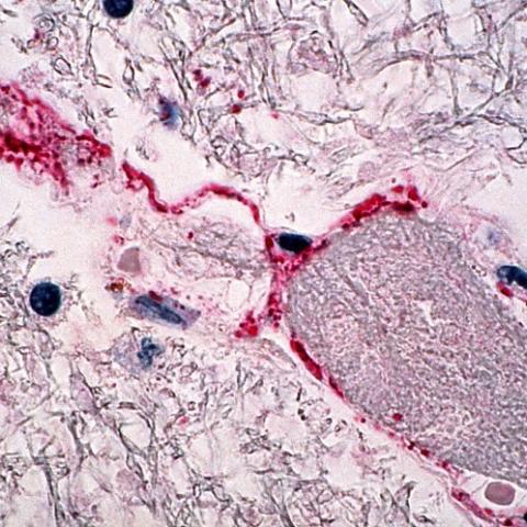 Virus Nipah 