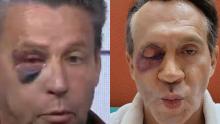 Arath de la Torre de "Hoy" se burla de golpiza a Alfredo Adame