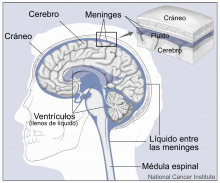 Cerebro