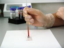 Cofepris emite el primer permiso de importación de tratamiento CAR-T para pacientes con leucemia