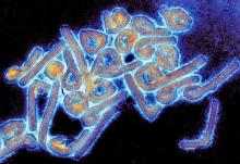 Virus de Marburgo 