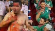 APUÑALADO COPA ORO MÉXICO