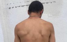 Fue detectado por la dueña de una casa en el Barrio de San Marcos