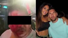 Golpean a hombre por supuesta foto