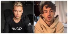 Liam Payne se encuentra hospitalizado por problemas renales