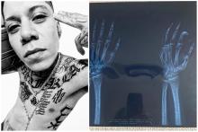 Mx