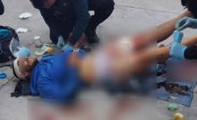 Esperaba su camión para ir a trabajar cuando fue atacado por el grupo de cobardes. ¡URGEN DONADORES DE SANGRE!