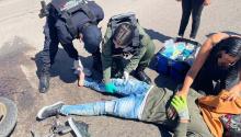 El menor de 16 años sufrió una fractura expuesta en la pierna derecha