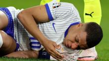 Mbappé nariz
