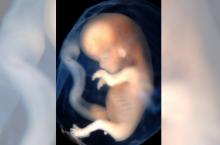 Aborto 