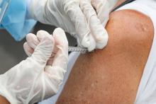 Auge de tosferina y sarampión se relaciona con falta de vacunación: ISSEA