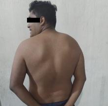 golpeador