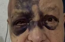 Luis de Alba aparece con fuertes golpes en el rostro
